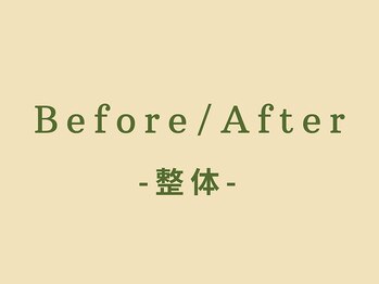 スロース鍼灸整体院(SLOTH鍼灸整体院)/整体Before/After