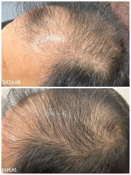 ヒルナム(Heal Nam)/プロセルセラピーズ~頭皮~