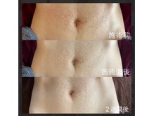 テラ(terra.)/幹細胞Lit