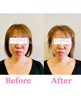 セルフィッシュ(Cellfish)/美容矯正・全身＆小顔
