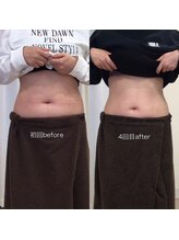 ジョワイユ(Joyeux)/腸の位置でお腹は変わる