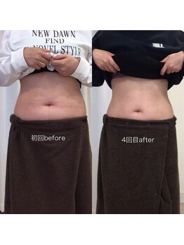 ジョワイユ(Joyeux)/腸の位置でお腹は変わる