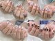 エムジーネイル(Mg Nail)の写真