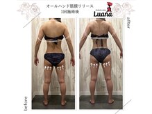 ルアナ(Luana)/オールハンド筋膜リリース