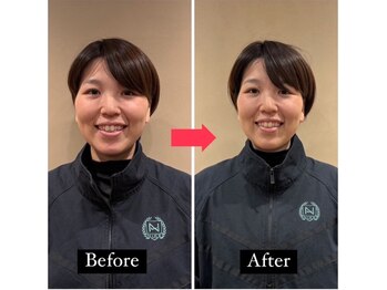 グランディ/1回の施術で確実に小顔へ!