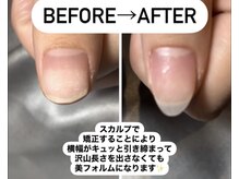 ネイルアトリエ ルアナ(LUANA)/スカルプで美爪形成