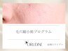 頬や小鼻まわりの毛穴がぽっかり開いて見える方【¥6,600のアフター化粧品付】