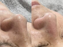 ナビ(nabi)/【フェイスワックス】