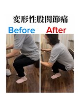 いぶき整体院 富山掛尾店/変化2