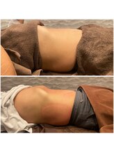 ビュウナ 銀座(BEAUNA)/脂肪冷却/frozen8