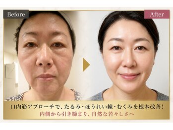 サロンチオリ 烏丸(Salon Chiori)の写真/土台から変える本格小顔矯正！全身の歪み・姿勢を整え、キュッと引き締まった理想のフェイスラインへ導く