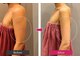 プシュケ(PSYCHE)の写真/「二の腕は隠すもの」を卒業！思わず出したくなる、シュッと華奢な二の腕へ。