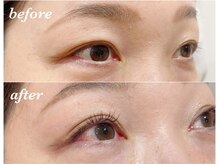 シュール センター南(SURREAL)/エクステ