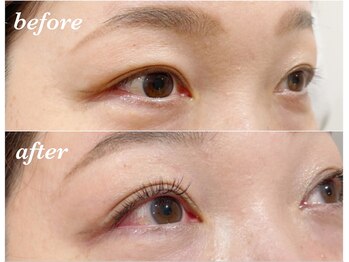 シュール センター南(SURREAL)/エクステ