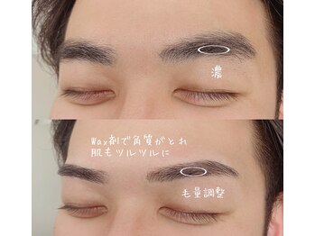 ヒース(Heath)/before&after