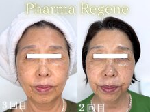 レイネ(REINE)/ファーマリジェネ/美肌三大要素