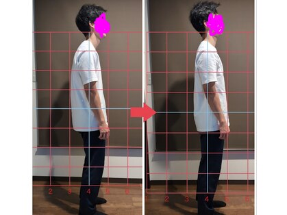 リバース(Re:Birth)の写真