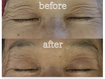 リル シャイン(Rill SHINE)/