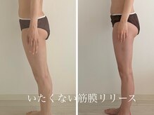 体のゆがみも整えるエステ。首肩こり/痩身/姿勢改善