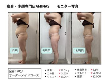 アミナス 渋谷店(AMINAS)/小顔ハイパーナイフでリフトUP!