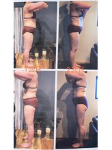 エスデザイン(es design)/リンパマッサージ／痩身／鹿児島