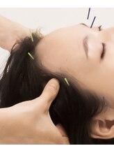 御茶の水ドライN鍼灸/頭痛・天気痛・頭重ケア