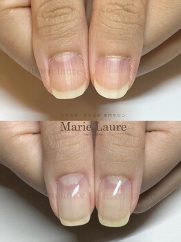 マリーロール 淀屋橋本店(Marie Laure)/深爪矯正/自爪育成/ネイルケア