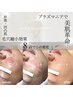 部分エステ【シミケア/毛穴開き・汚れ/凹凸肌】頬のみプラズマニア¥10,000→