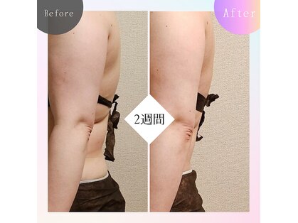 ヨサパーク リアン 郡山店(YOSA PARK Lien)の写真