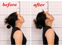 プーラビタ(PURAVITA)/首こり可動域改善 before after