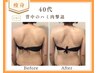 【背中】キャビ×ラジオ波で“ハミ肉集中”コース