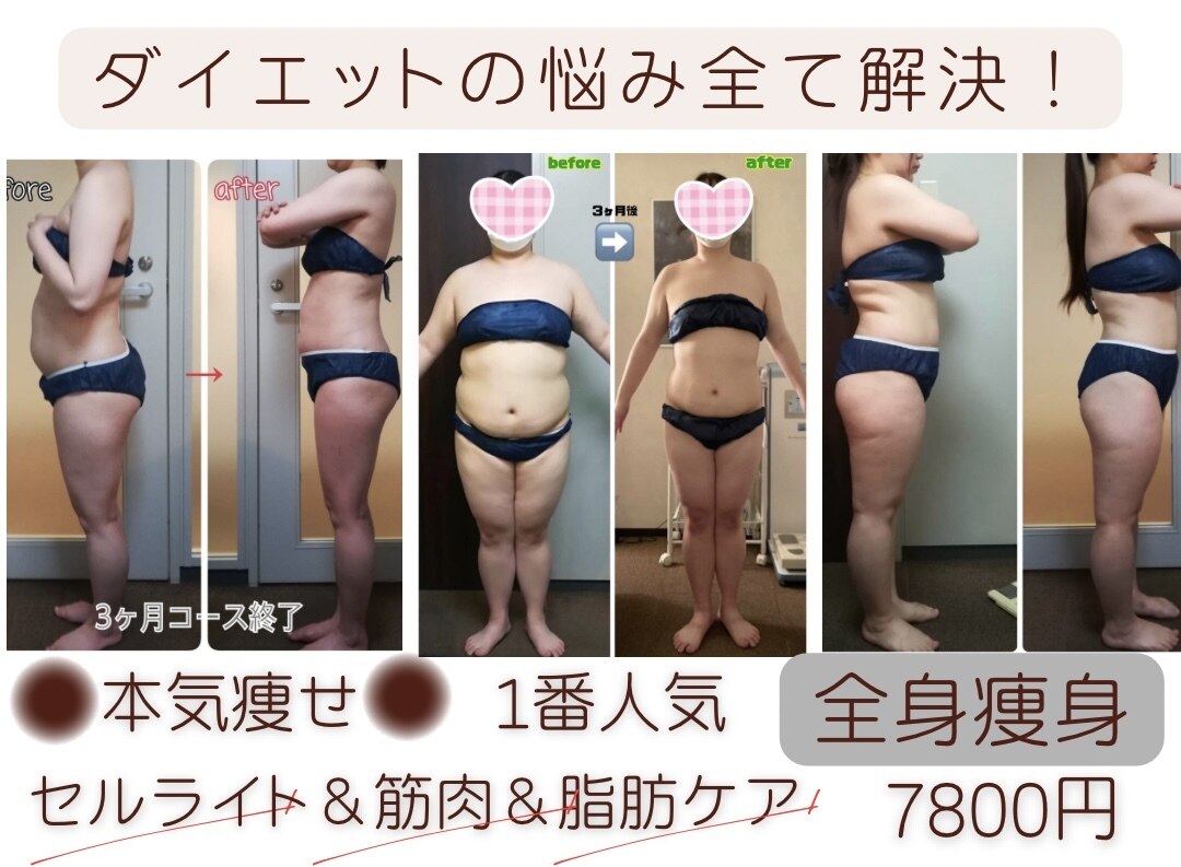 ダイエット サポート(DIET SUPPORT)｜ホットペッパービューティー