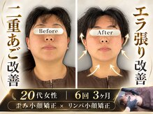 エレヴィザ トウキョウ 恵比寿院(ELVISA TOKYO)