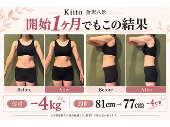 キート美容鍼灸 整体院(Kiito美容鍼灸 整体院)の写真/「去年より太った…？」薄着になって焦った今が始め時！3ヶ月で変わる本気の体質変化