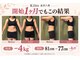 キート美容鍼灸 整体院(Kiito美容鍼灸 整体院)の写真/「去年より太った…？」薄着になって焦った今が始め時！3ヶ月で変わる本気の体質変化