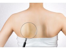 リリービューティー(lily beauty)の雰囲気（肩甲骨周りの詰まりを放置すると肩、背中のコリの原因となります）