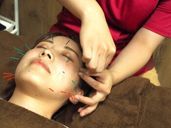 鍼灸ライフ整骨院/■美容鍼×ヒト幹細胞培養美容液