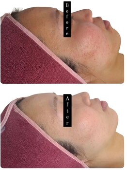 サロン ド ハニー(Salon de Honey)/