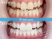 ホワイトニングカフェ つくば研究学園店