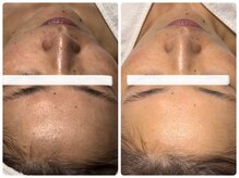 ベルドア(Bell Door)/くすみ/シミケア/透明感アップ