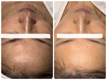 ベルドア(Bell Door)/くすみ/シミケア/透明感アップ