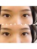 【4週間以内】LEDフラットラッシュ80本