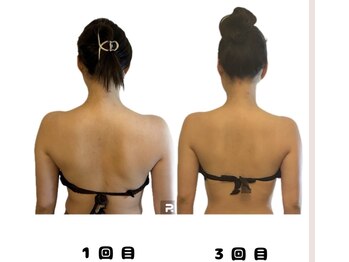 ワ(Wa)/美容整体変化