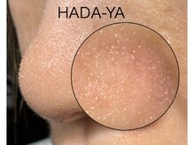 肌屋(HADA-YA)/
