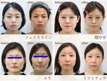 美デザイン 広島並木通り店(美.design)