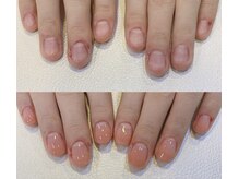 エルフィ(ELFI)/深爪