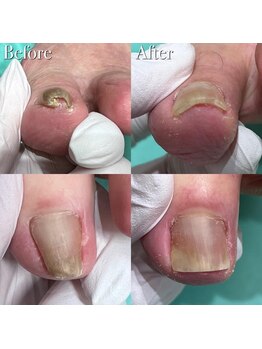 巻き爪補正店 横浜駅前店/