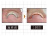 "巻き爪さん”必見!次世代FOOT巻き爪改善ジェル＋うる艶ワンカラー¥12000
