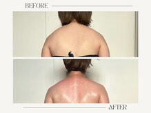 シーアンル(C.aneL)/重くてだるい肩首コリ解消