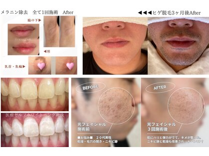 ワイスタイル(Ystyle)の写真